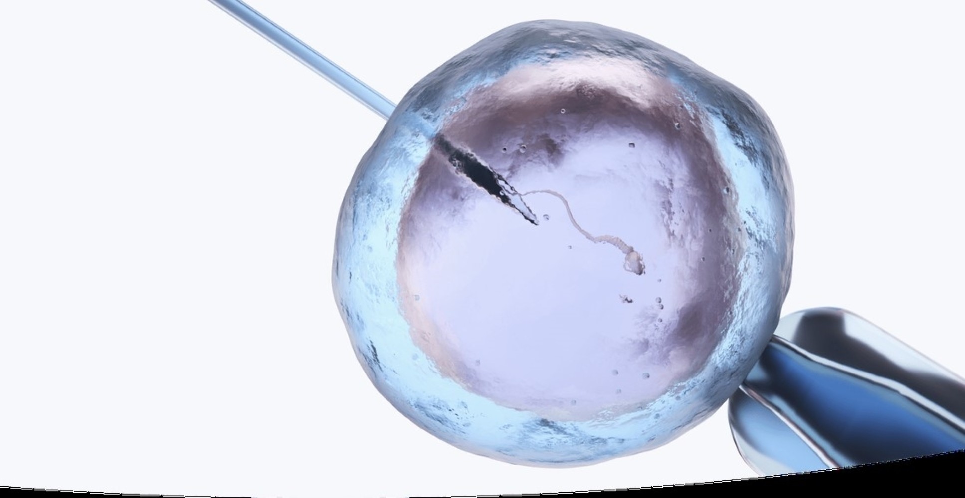 IVF and Micromanipulation